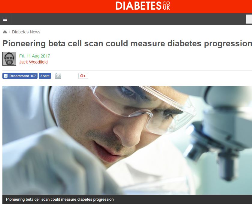 Pioneering beta cell scan could measure diabetes progression